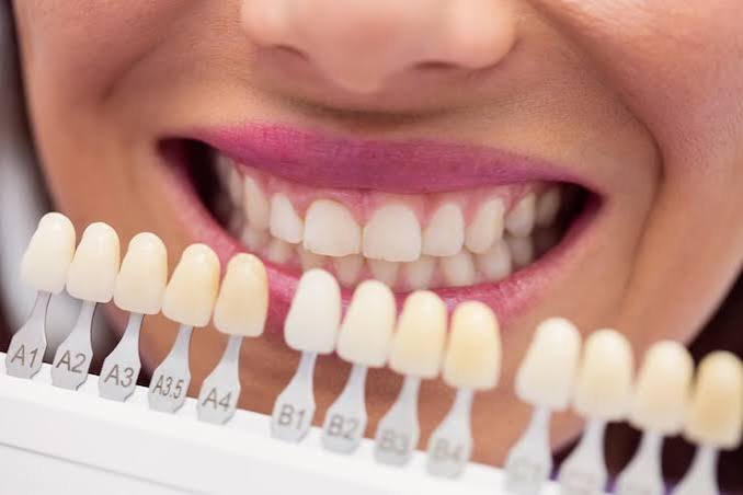 Cosmetic dentistry