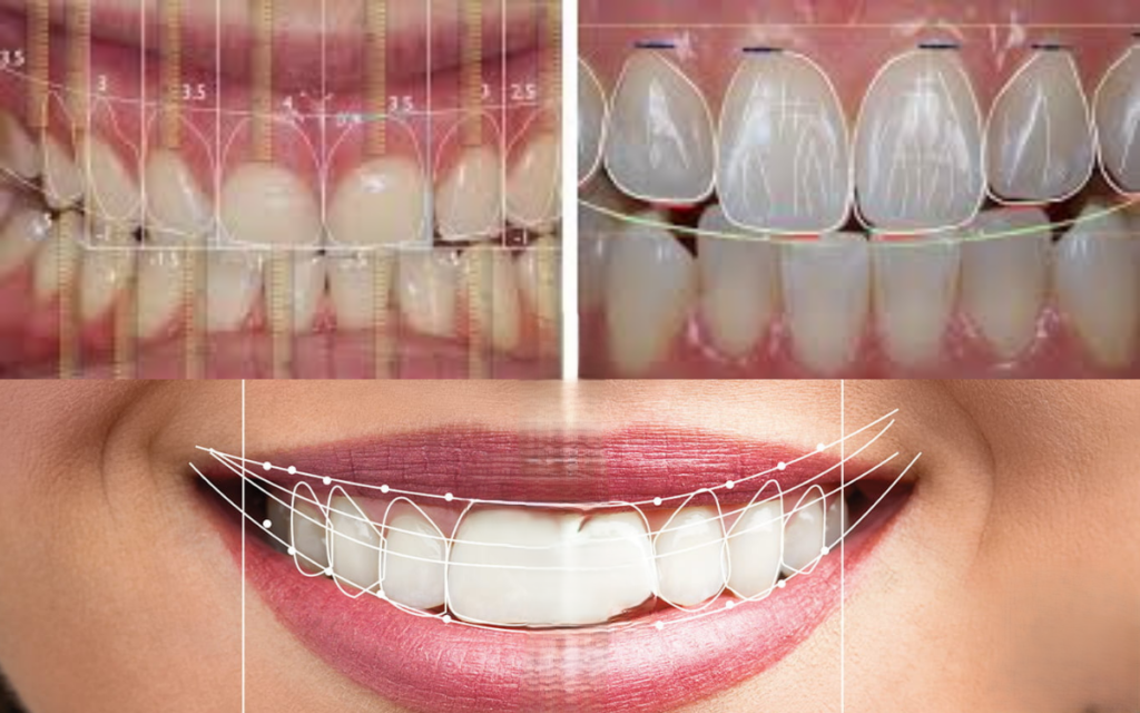 Digital smile makeover